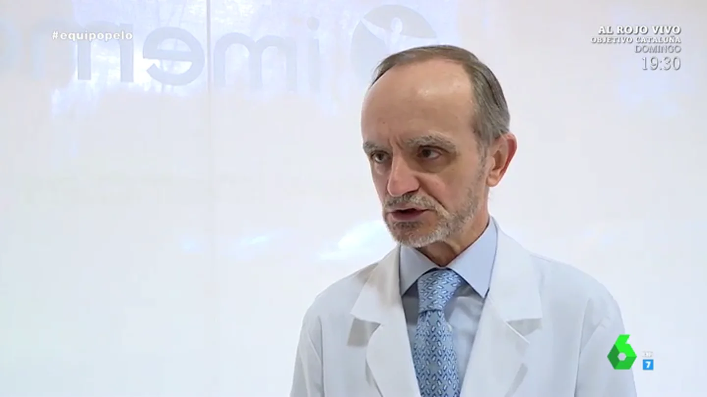 No todo el mundo se puede hacer un trasplante de pelo: un médico advierte sobre las clínicas que solo buscan hacer negocio No todo el mundo se puede hacer un trasplante de pelo: un médico advierte sobre las clínicas que solo buscan hacer negocio