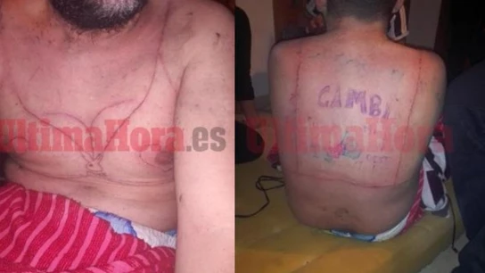 Imagen del hombre torturado en Manacor Imagen del hombre torturado en Manacor