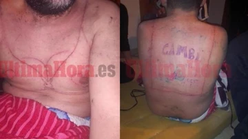 Imagen del hombre torturado en Manacor