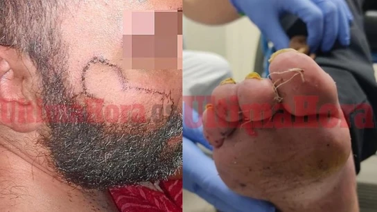 Imagen del joven torturado en Manacor Imagen del joven torturado en Manacor