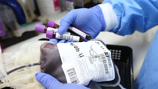 Transfusión de sangre Transfusión de sangre