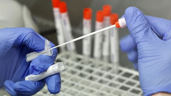 Test PCR Test PCR