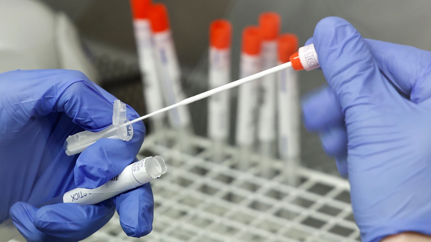Test PCR Test PCR
