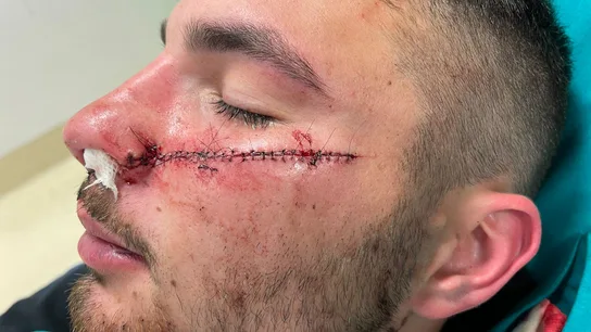 La brutal agresión con cuchillo de un menor a un 'rider' por defender a una joven: "Lo volvería a hacer" La brutal agresión con cuchillo de un menor a un 'rider' por defender a una joven: "Lo volvería a hacer"
