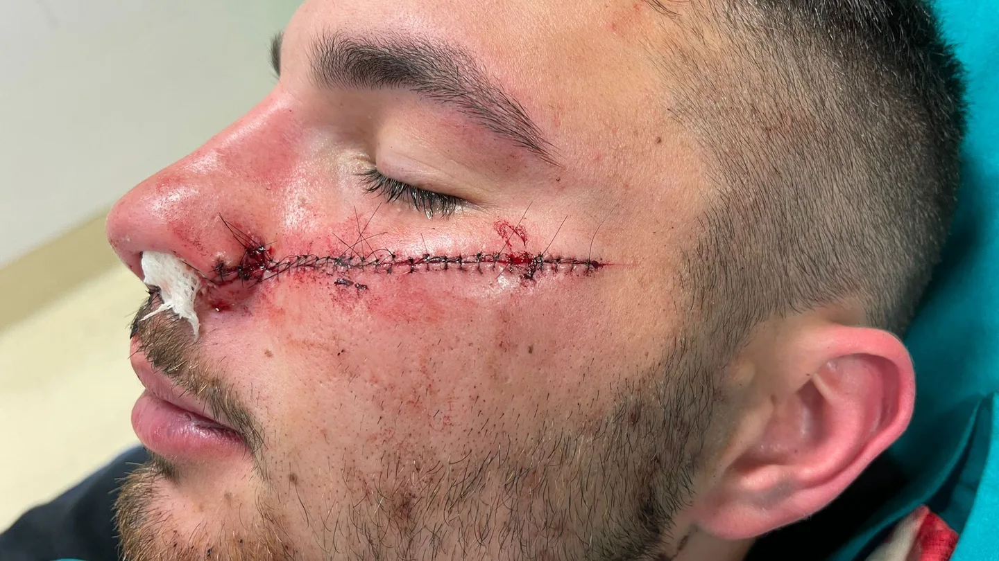 La brutal agresión con cuchillo de un menor a un 'rider' por defender a una joven: "Lo volvería a hacer" La brutal agresión con cuchillo de un menor a un 'rider' por defender a una joven: "Lo volvería a hacer"