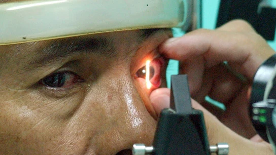 Revisión de la vista Revisión de la vista