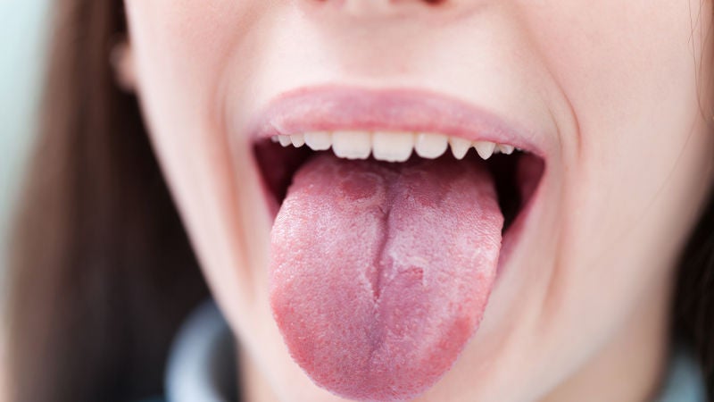 Lengua gigante y otros síntomas menos comunes del coronavirus
