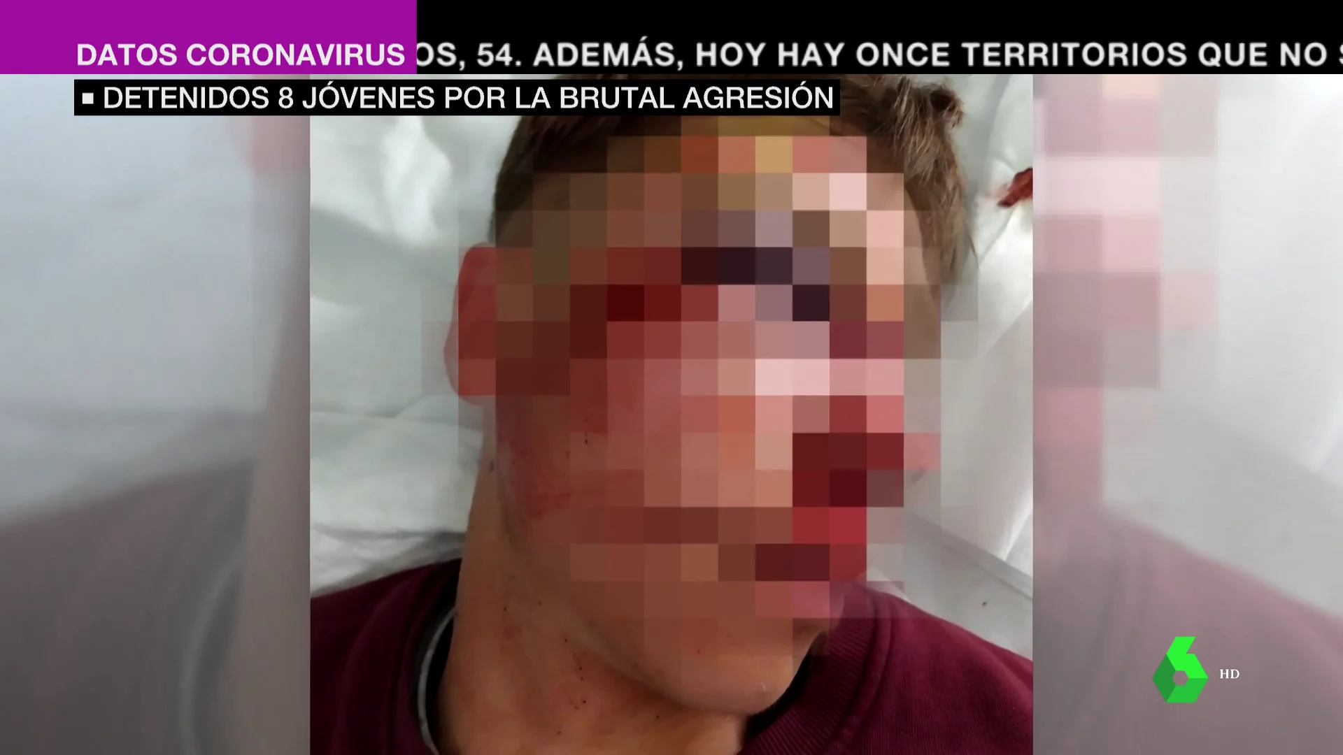 El joven agredido en Parla