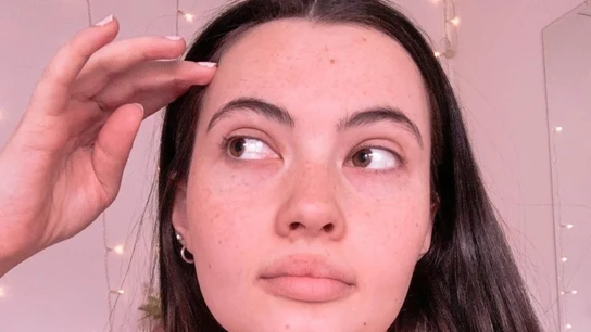 La joven usa sus redes sociales para dar visibilidad a la enfermedad rara que padece. La joven usa sus redes sociales para dar visibilidad a la enfermedad rara que padece.