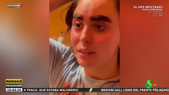 Una joven muestra cómo acaban sus cejas tras aplicar un tinte permanente Una joven muestra cómo acaban sus cejas tras aplicar un tinte permanente
