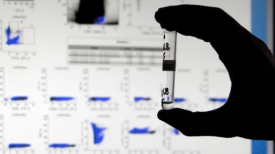 Científicos españoles desarrollan un test capaz de detectar los anticuerpos 'invisibles' contra el COVID Científicos españoles desarrollan un test capaz de detectar los anticuerpos 'invisibles' contra el COVID