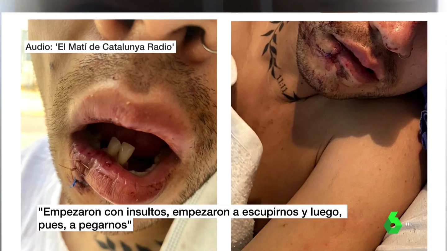 agresion homofoba agresion homofoba