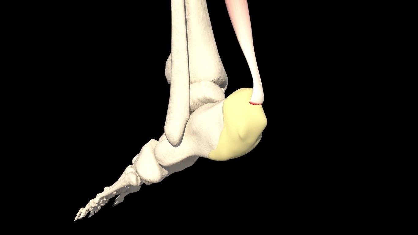 Chasquido de las articulaciones