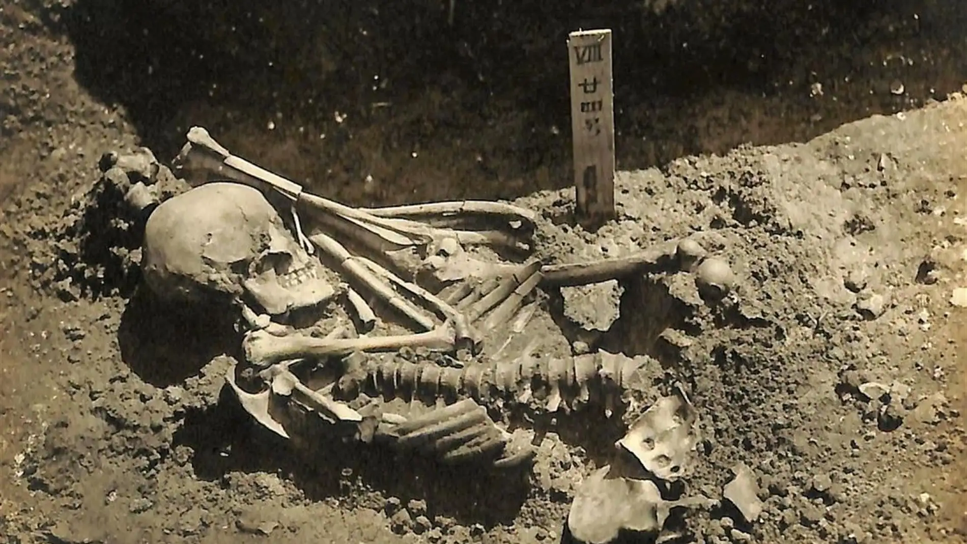 Un hombre muerto hace 3.000 anos la primera victima conocida de un tiburon