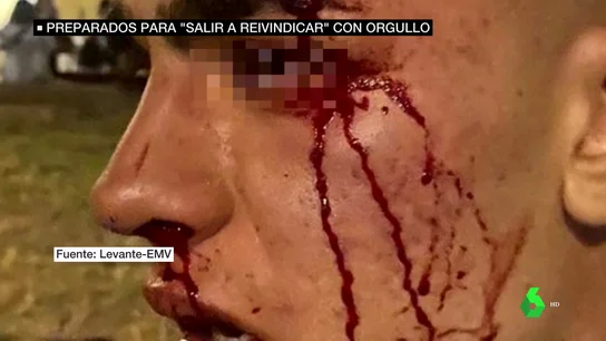 agresiones homófobas agresiones homófobas