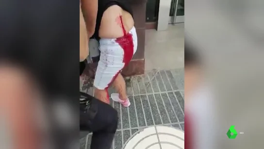 Imagen de la agresión racista a una mujer en Murcia Imagen de la agresión racista a una mujer en Murcia