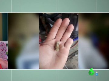 "Ya no encaja, se ha consumido": un hombre encuentra su dedo meñique seis meses después de amputárselo en un accidente
