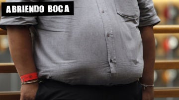 Imagen de archivo de una persona con obesidad