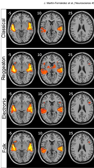 El reguetón provoca mayor actividad cerebral que escuchar clásica o folclore El reguetón provoca mayor actividad cerebral que escuchar clásica o folclore