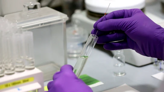 Una vacuna contra el COVID Una vacuna contra el COVID