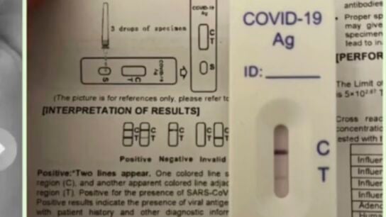 La c&oacute;mica reacci&oacute;n de un padre al confundir el test COVID de su hija con un test de embarazo: "Ponte un DIU"