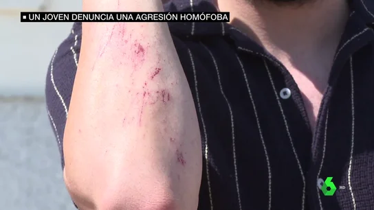 agresión homófoba agresión homófoba