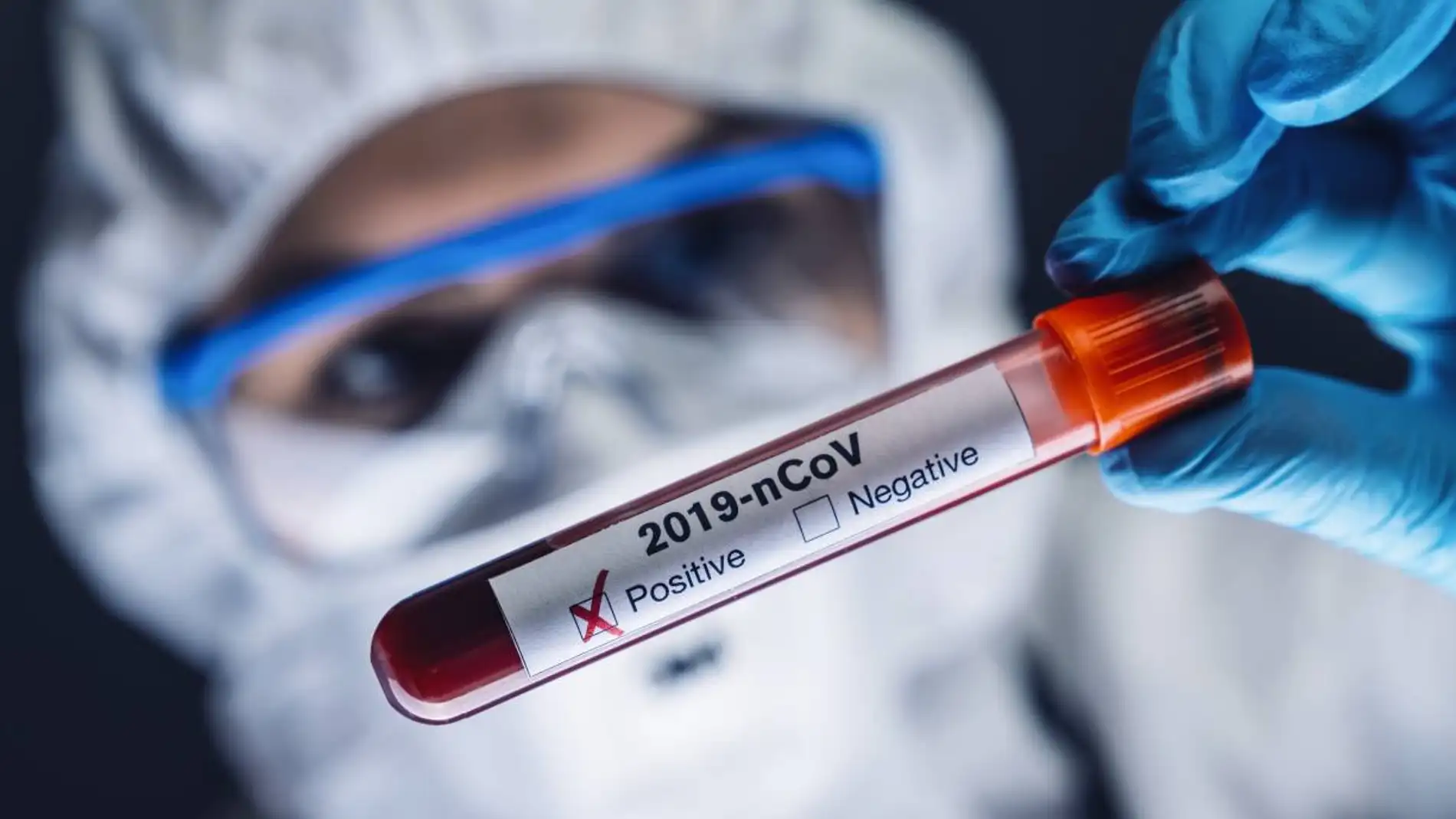 Dos estudios asocian nuevos defectos geneticos e inmunologicos con la covid grave