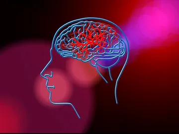La Inteligencia Artificial permite calcular el riesgo individual de un ictus La Inteligencia Artificial permite calcular el riesgo individual de un ictus