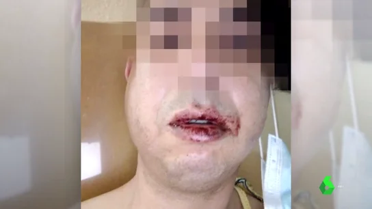 victima agresion homofoba victima agresion homofoba