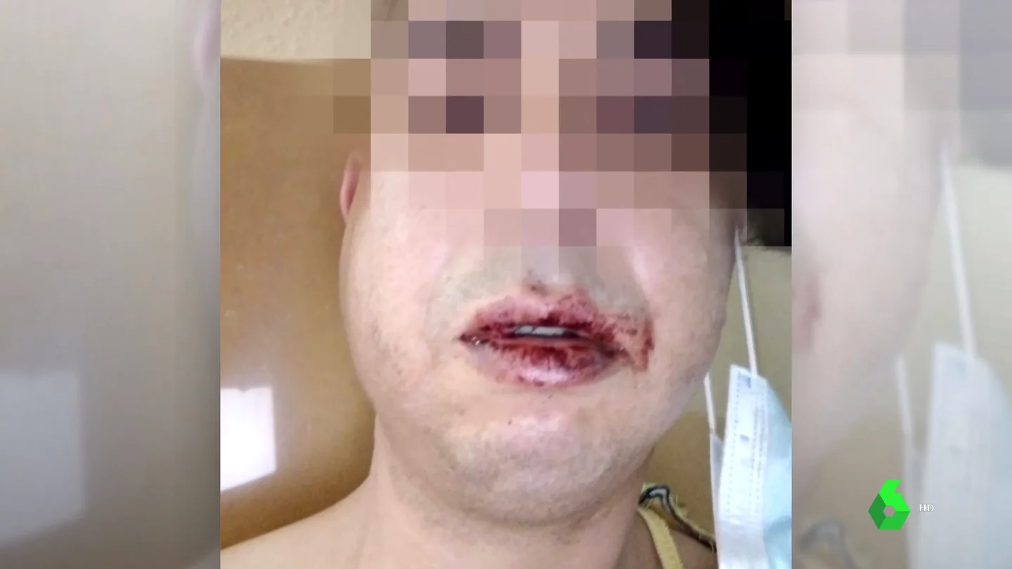 victima agresion homofoba victima agresion homofoba