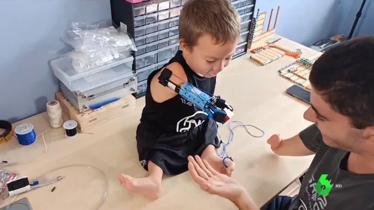 Un joven crea una prótesis de Lego para un niño de ocho años Un joven crea una prótesis de Lego para un niño de ocho años