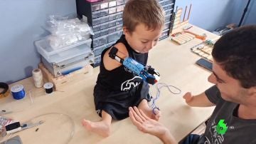 Un joven crea una prótesis de Lego para un niño de ocho años