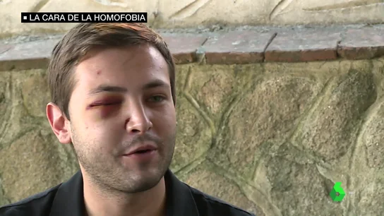 Agreden a un joven a puñetazos en Velada (Toledo) al grito de "pierdes aceite, eres maricón" Agreden a un joven a puñetazos en Velada (Toledo) al grito de "pierdes aceite, eres maricón"