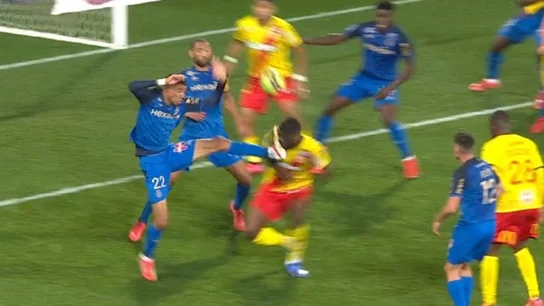 Brutal patada en la cara en la Ligue 1 Brutal patada en la cara en la Ligue 1