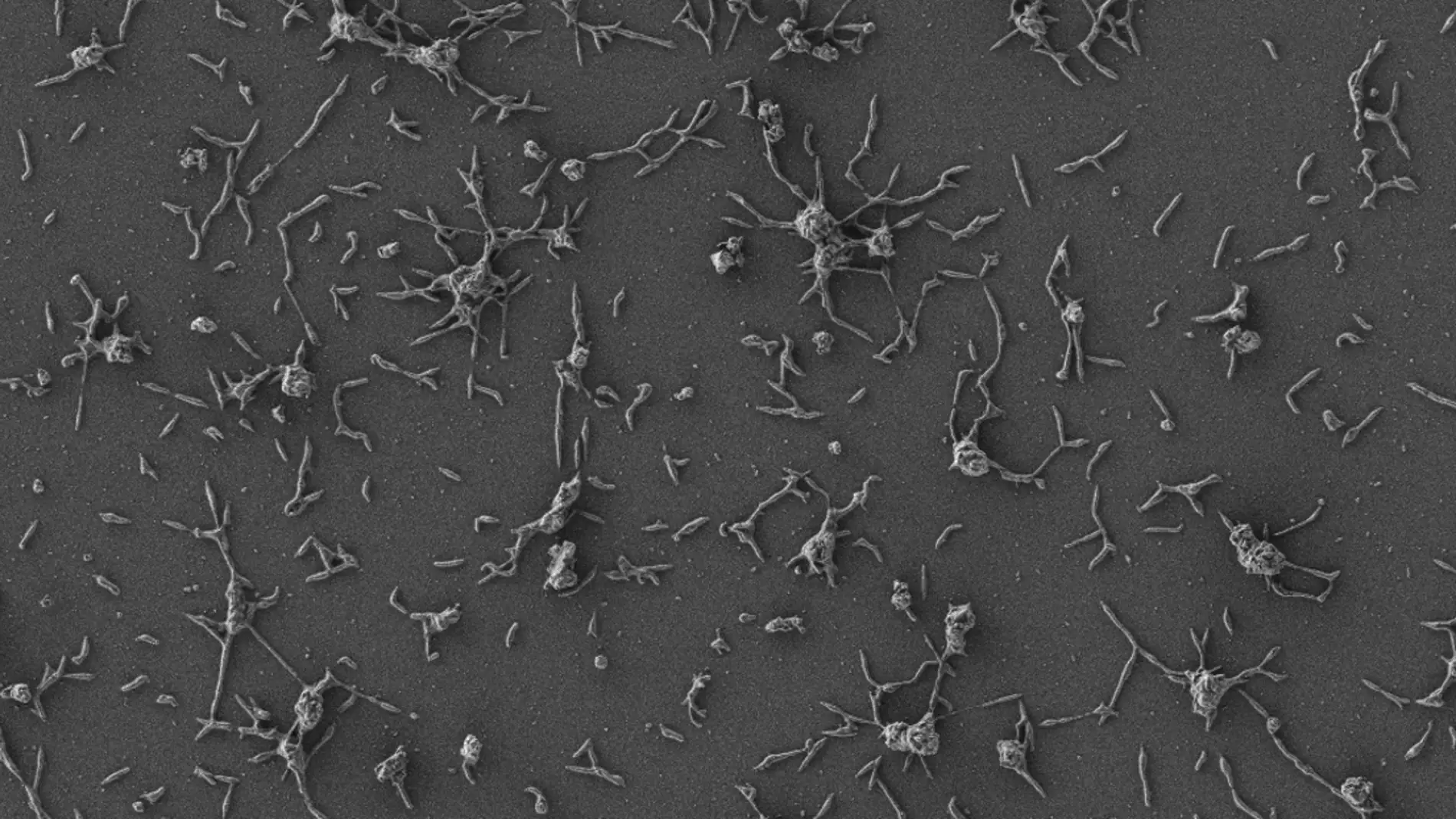 Células de Mycoplasma pneumoniae