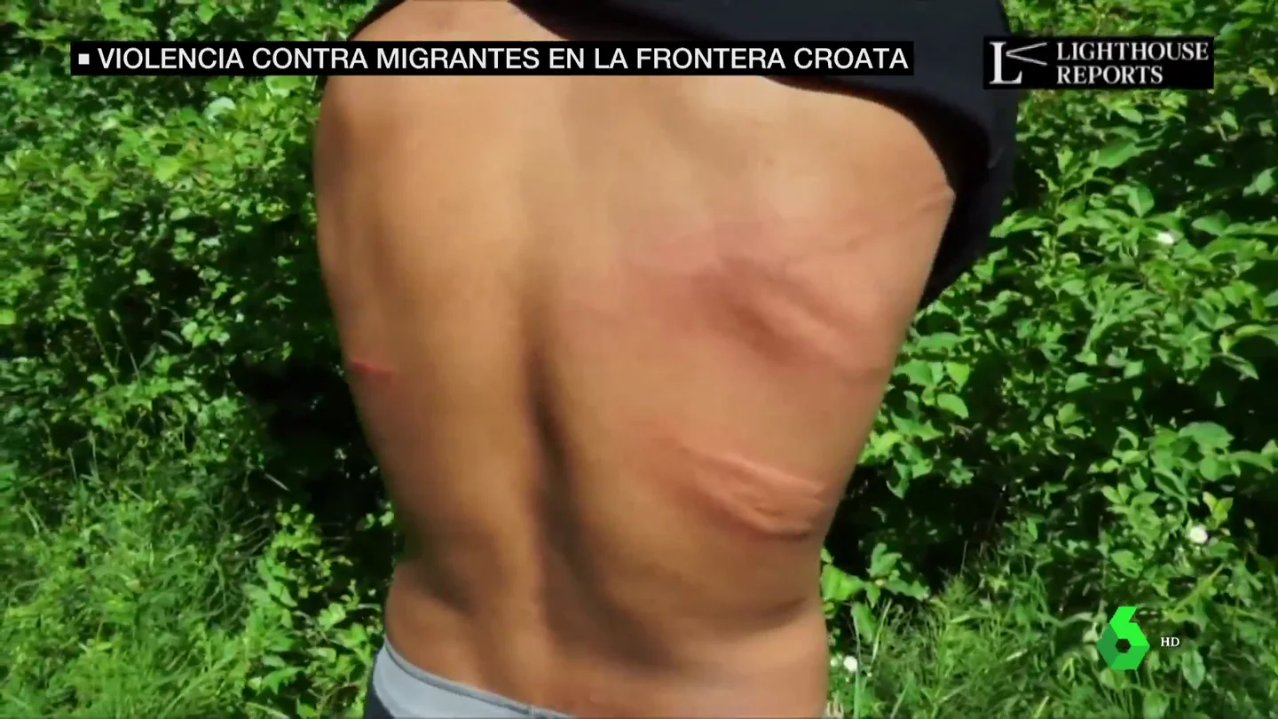 Las impactantes imágenes de brutales palizas a migrantes bosnios en la frontera croata Las impactantes imágenes de brutales palizas a migrantes bosnios en la frontera croata