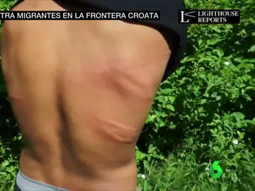 Las impactantes imágenes de brutales palizas a migrantes bosnios en la frontera croata