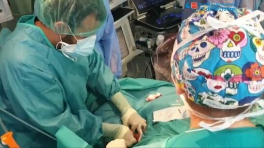 Utilizan un pulm&oacute;n artificial para la recuperaci&oacute;n de una paciente embarazada con COVID-19