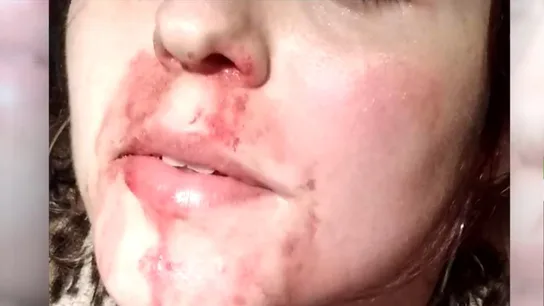 "Tú no eres una mujer, te voy a matar": la víctima de la brutal agresión en la Línea relata los insultos tránsfobos que recibió "Tú no eres una mujer, te voy a matar": la víctima de la brutal agresión en la Línea relata los insultos tránsfobos que recibió