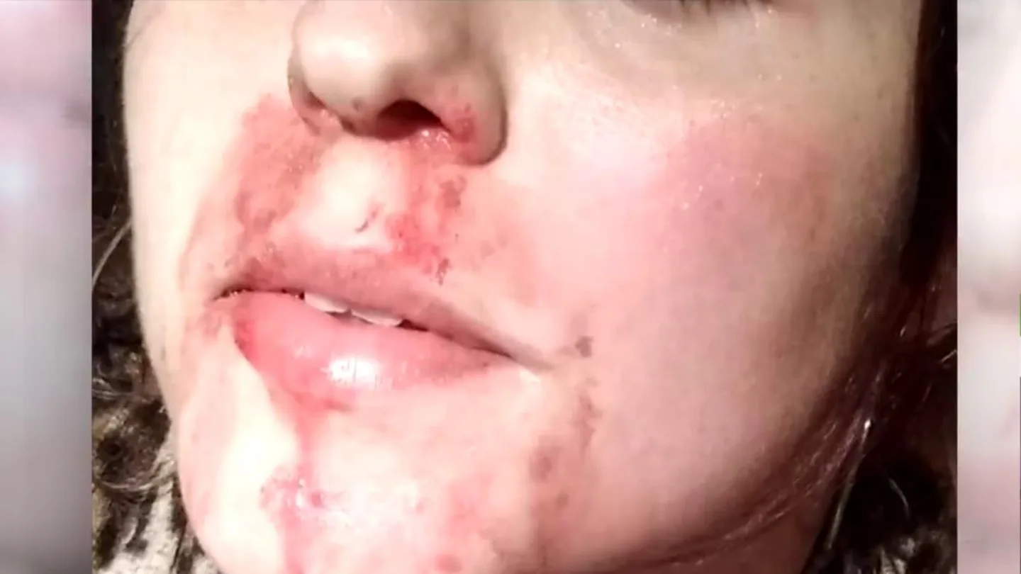 "Tú no eres una mujer, te voy a matar": la víctima de la brutal agresión en la Línea relata los insultos tránsfobos que recibió "Tú no eres una mujer, te voy a matar": la víctima de la brutal agresión en la Línea relata los insultos tránsfobos que recibió