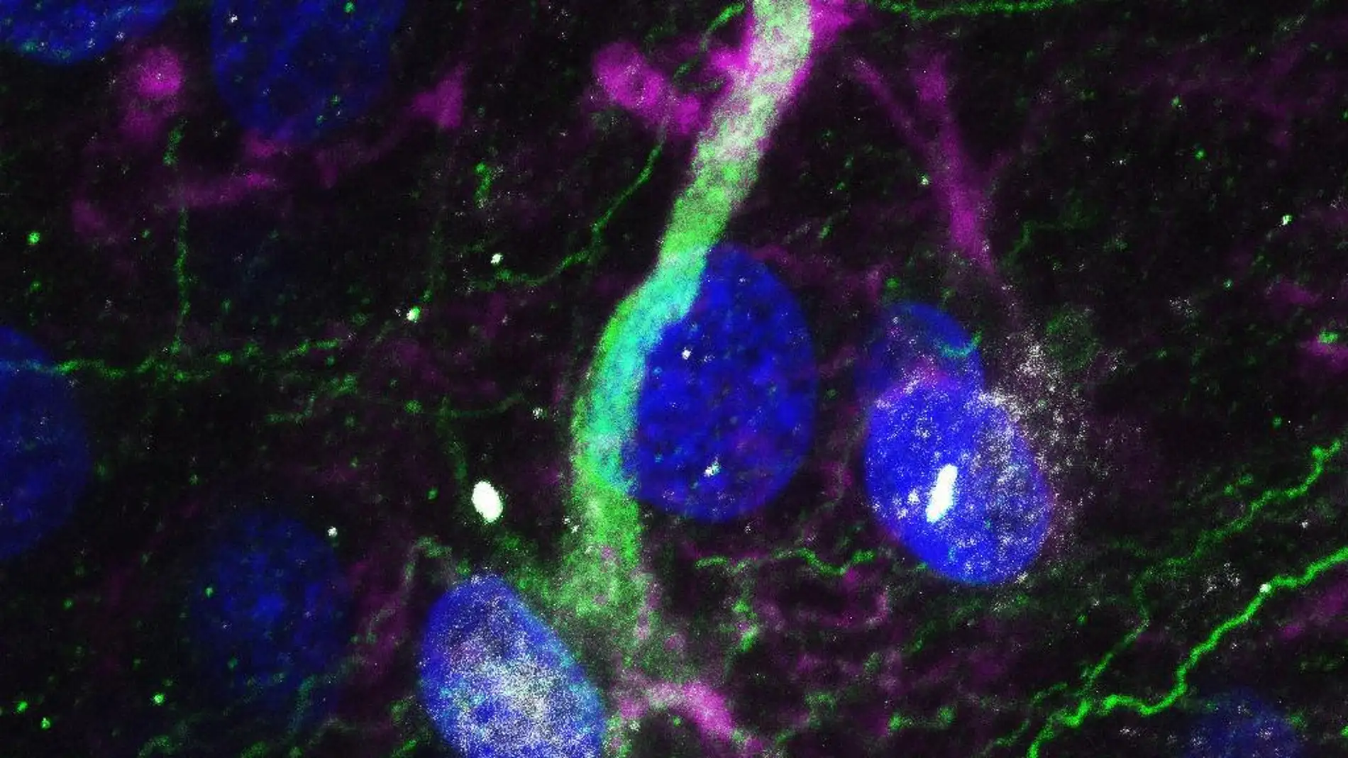 Imagen de una célula madre en el hipocampo humano adulto