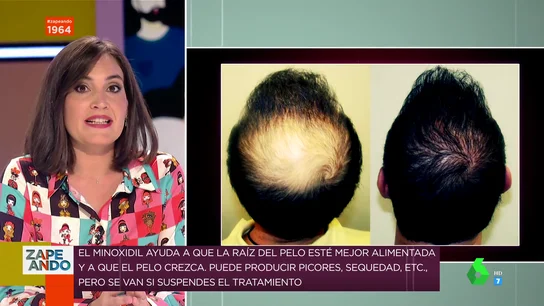 Sí, existe: Boticaria García explica cuál es el tratamiento más efectivo para evitar la caída del pelo Sí, existe: Boticaria García explica cuál es el tratamiento más efectivo para evitar la caída del pelo