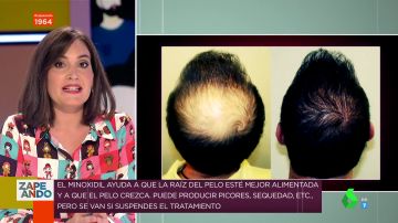 Sí, existe: Boticaria García explica cuál es el tratamiento más efectivo para evitar la caída del pelo
