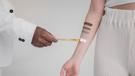 Piel, color, manchas