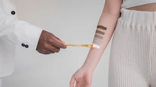 Piel, color, manchas Piel, color, manchas