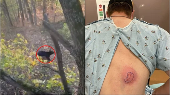 Un oso ataca por la espalda a un jugador de béisbol mientras cazaba ciervos Un oso ataca por la espalda a un jugador de béisbol mientras cazaba ciervos