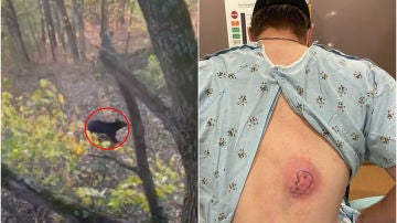 Un oso ataca por la espalda a un jugador de béisbol mientras cazaba ciervos