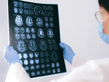 Médico observando un escáner cerebral Médico observando un escáner cerebral