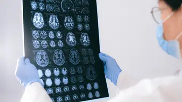 Médico observando un escáner cerebral