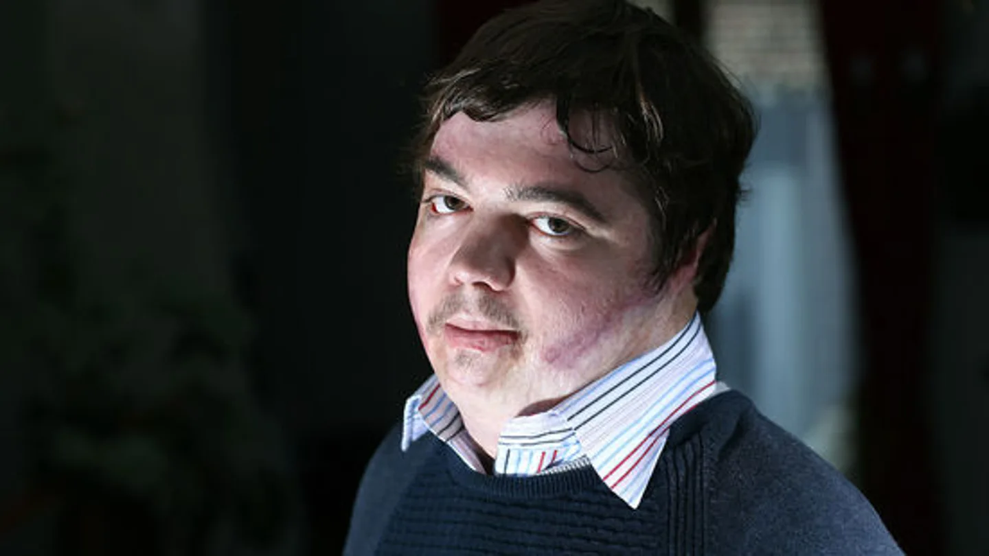 ¿Quién es Jonathan Destin? Protagonista de la película 'El día que quemé mi corazón' Bullying